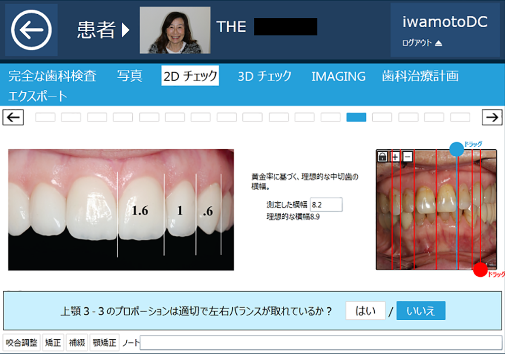 歯の横幅の分析